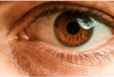 Stye or Meibomian Cyst? How to Tell the Difference and What to Do About It 