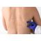 Your Guide to Seborrhoeic Keratosis: From Causes to Care 